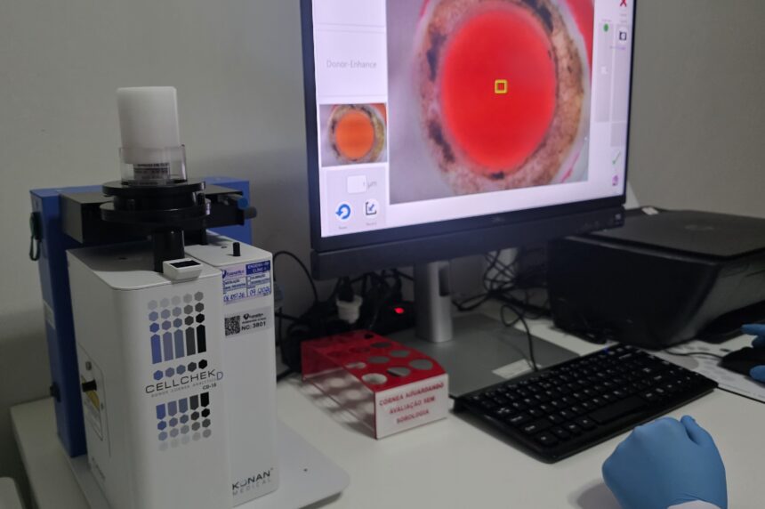 Banco de Olhos em Vila Velha: Equipamento médico de alta tecnologia japonês Konan no Hospital Evangélico.