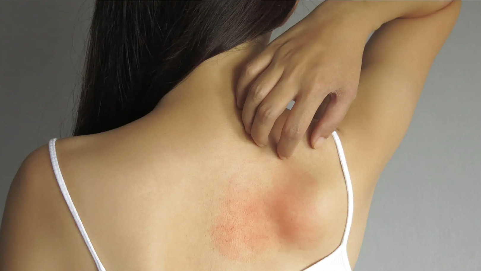 Fibromialgia em Anchieta: Câmara Municipal derruba veto a projeto de lei de proteção.